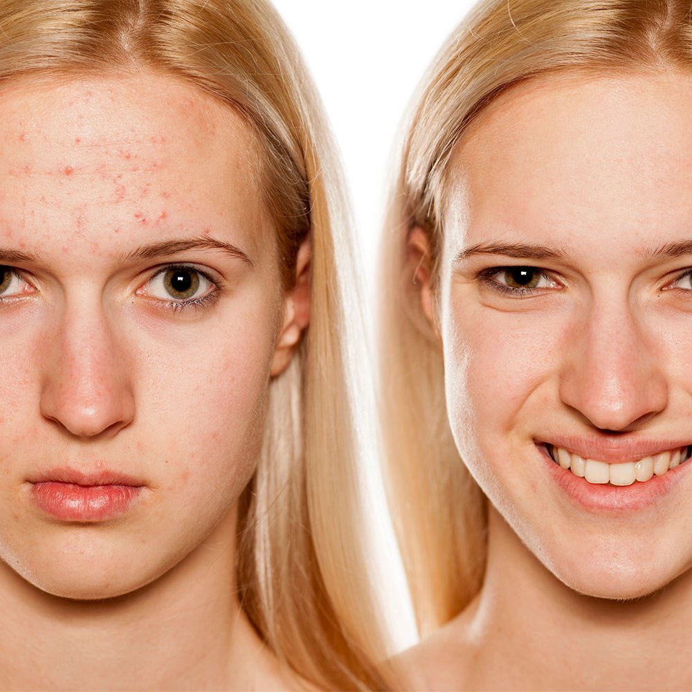 GlowClinic™ RadianceLift LED Mask (Roodlicht + NIR Infrarood)